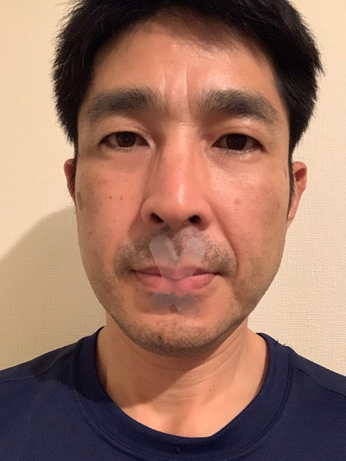 口閉じテープ 鼻呼吸テープ
